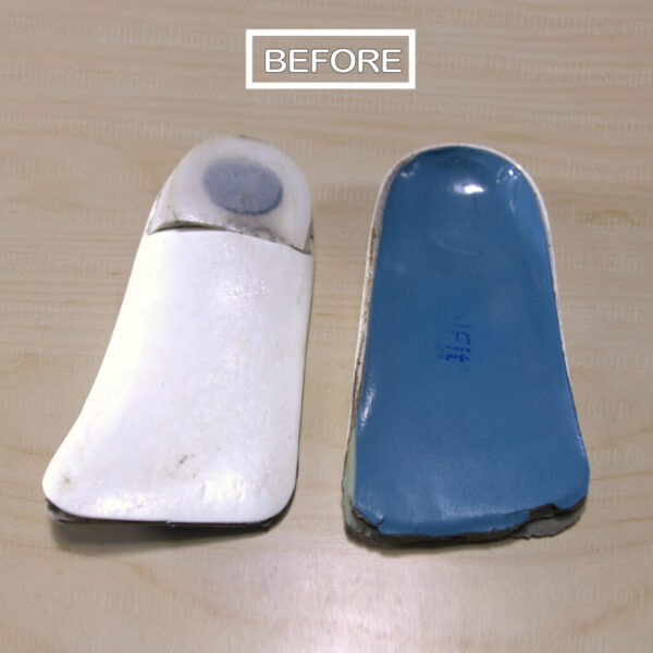Restore All (Full refurbish service) - Image 2
